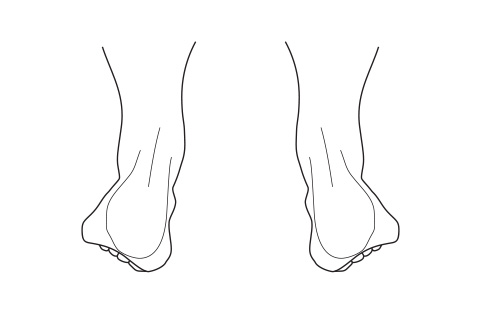 Pronated feet