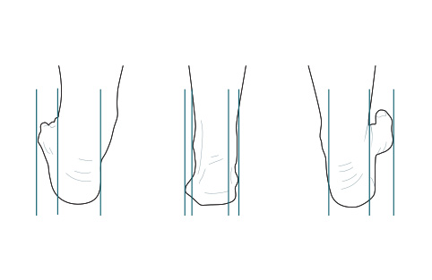 Too many toes test
